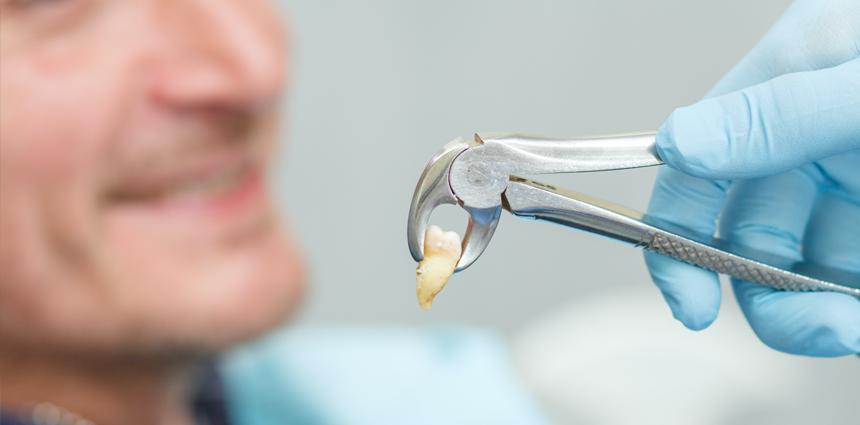 teeth treatment